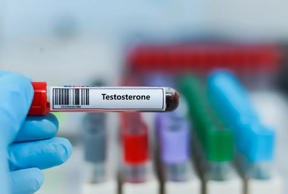 Testosterone blood test